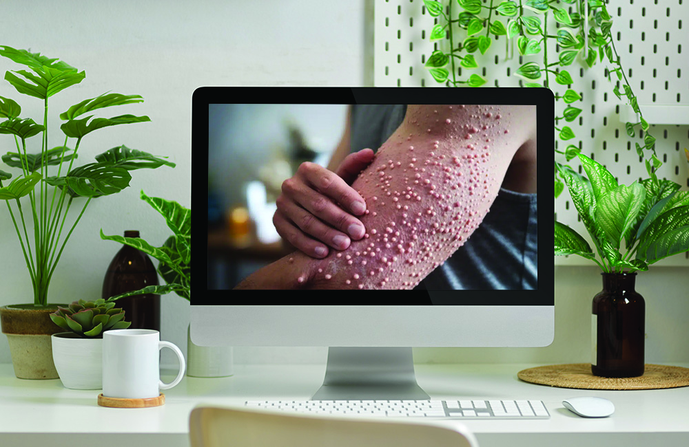 Dermatologie tropicale